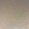 Artex