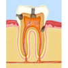 Tooth structure