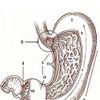 Gastrectomy