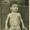 Juvenile idiopathic arthritis