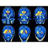MRI contrast agent