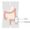 Colostomy